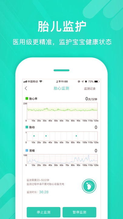 心动孕育