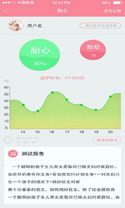 宜嘉贝贝