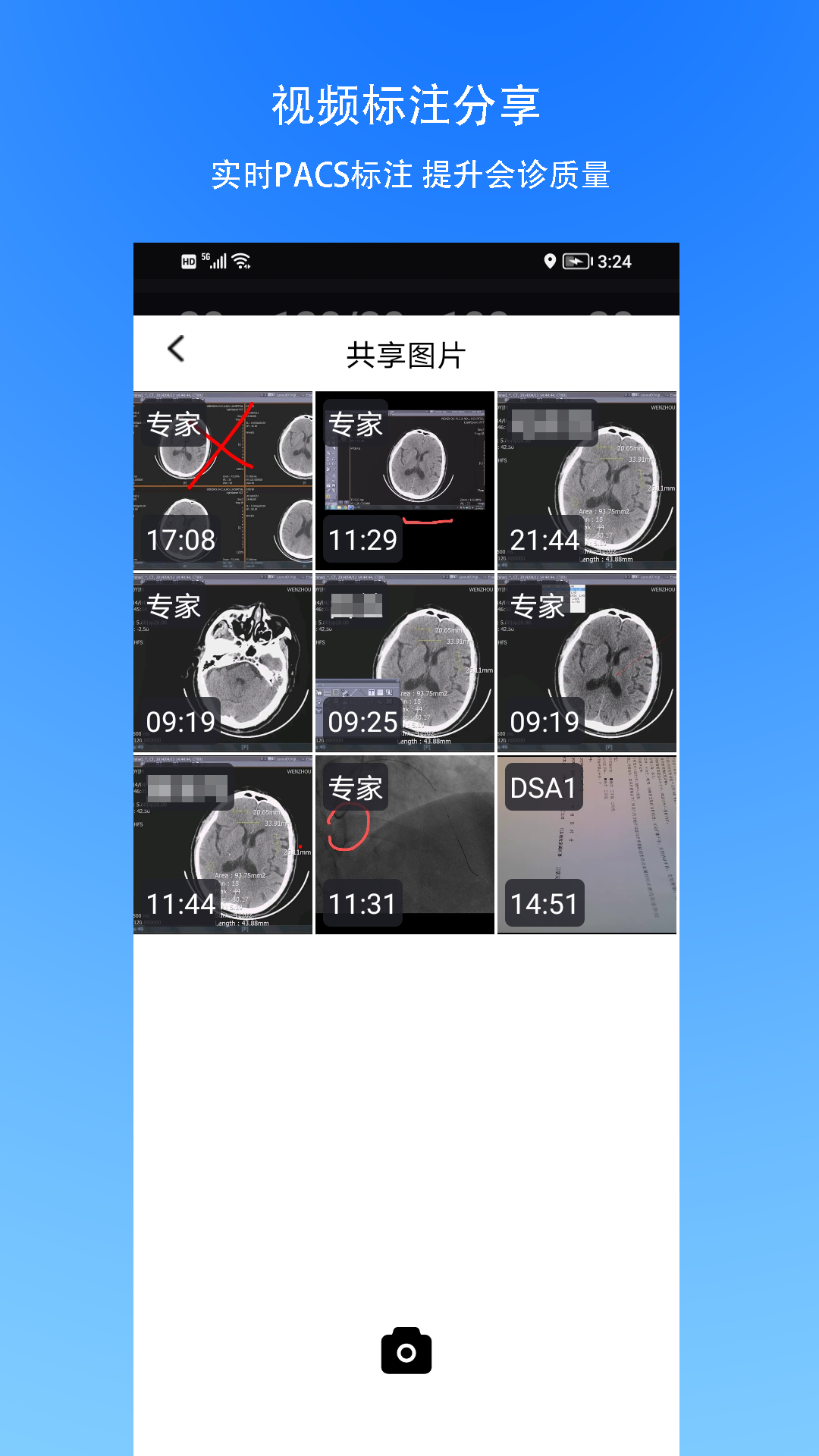 手术指导会诊
