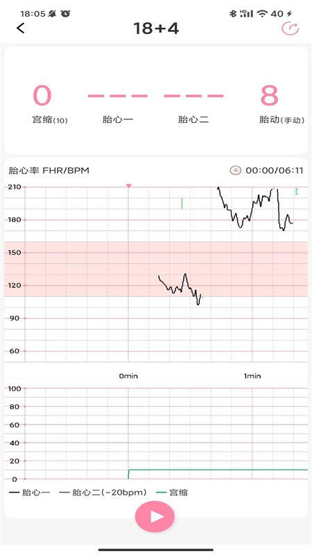 十月宝贝孕妇版
